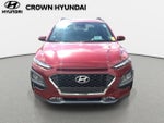 2020 Hyundai Kona Ultimate