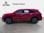 2020 Acura MDX w/Technology Pkg